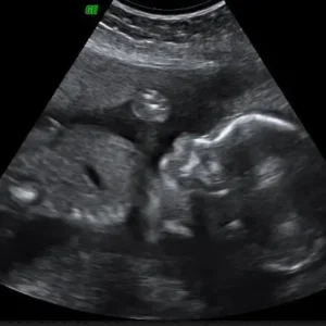 2D ultrasound Los Angeles