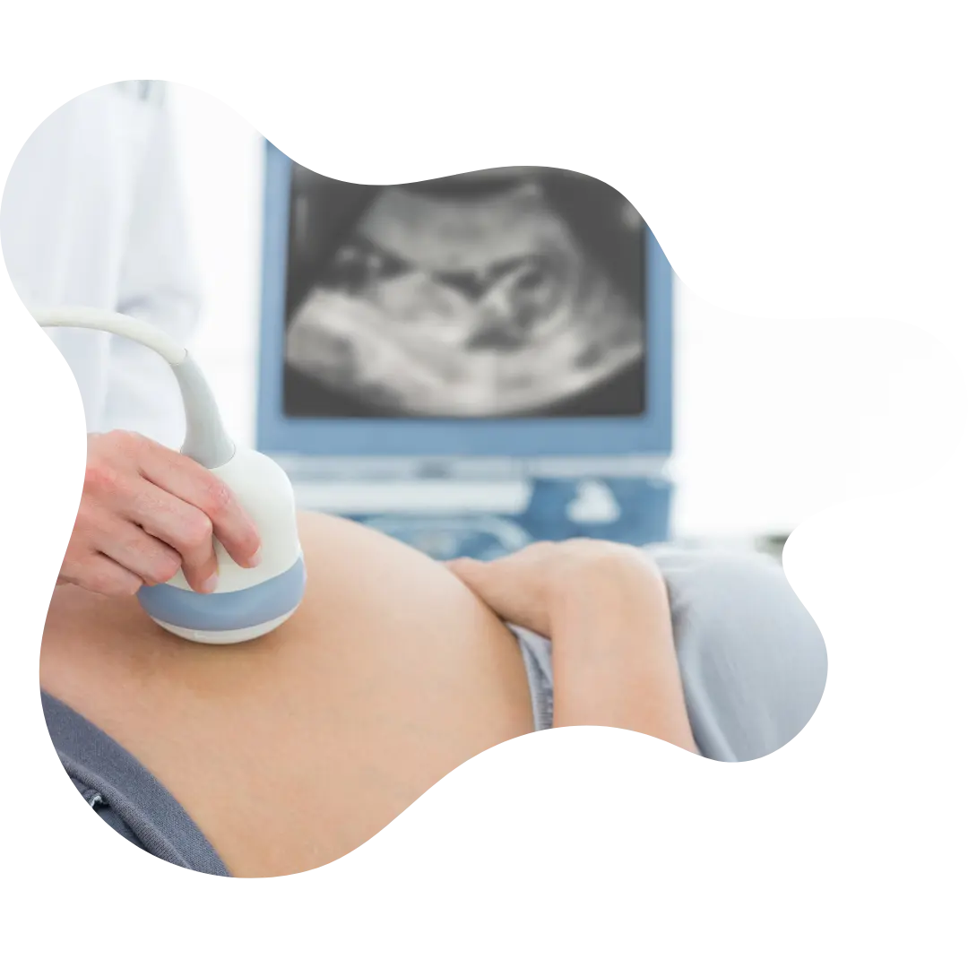 gender reveal ultrasound